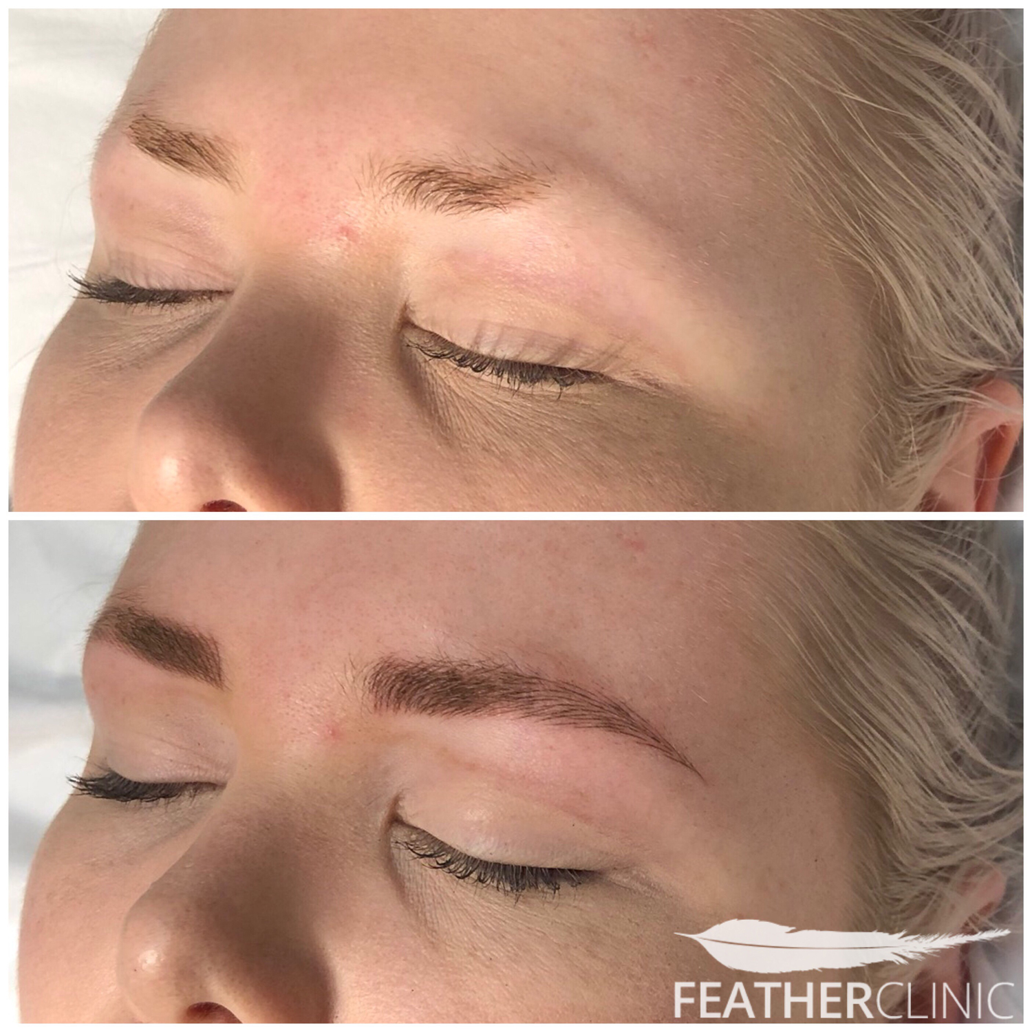 Why Microblading (Feather Touch Brows) is Not the Best Choice for Everyone  - Unique Blendz
